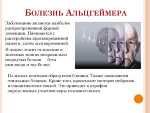 Чем отличается старческая деменция от болезни альцгеймера